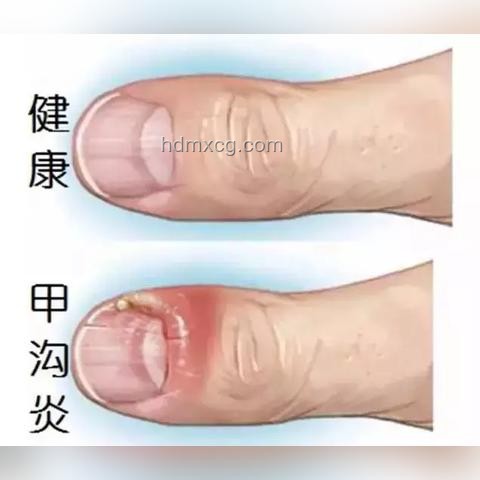 浙江女子牙疼切开脓肿发现20多种细菌：深度医疗案例分析